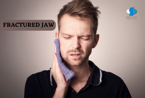 FRACTURED JAW